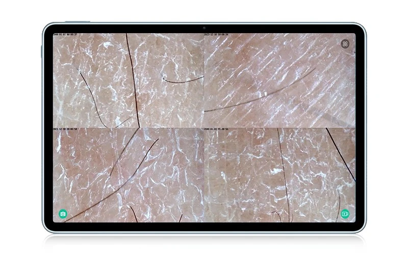 skin